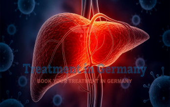Dendritic Cell Therapy and TACE treatment for Stage 4 Liver Cancer patients in Germany