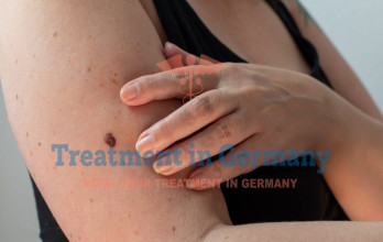 Dendritic Cell Therapy for Melanoma Patients in Germany