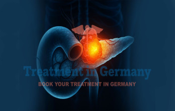 Dendritic Cell Therapy for Stage 4 Pancreatic Cancer in Germany