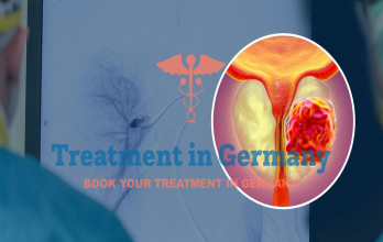 TACP Treatment for Prostate Cancer Patients in Germany
