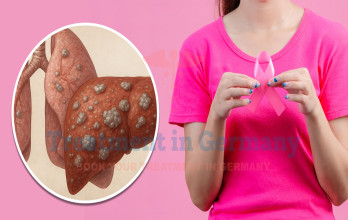 Breast Cancer with Liver and Lung Metastasis