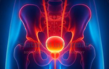 Stage 4 Bladder Cancer Treatment in Germany: Metastatic Treatment and Survival Rate