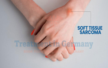 Soft Tissue Sarcoma Treatment in Germany: Types, Staging, and Treatment