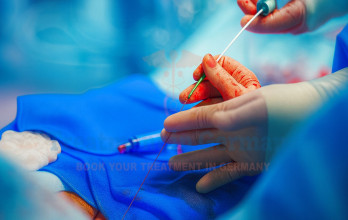 Cancer Treatment with TACE Therapy in Germany