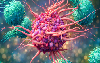 Cancer Treatment in Germany with Dendritic Cell Therapy