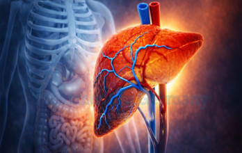 Advance Metastatic Liver Cancer Treatment Options in Germany