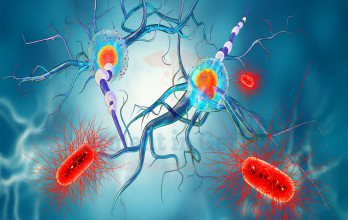 What Is Dendritic Cell Therapy for Cancer?